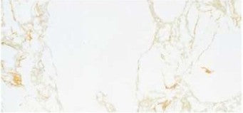 Engineerd Marbles_GJS巴洛克金_thumbnail